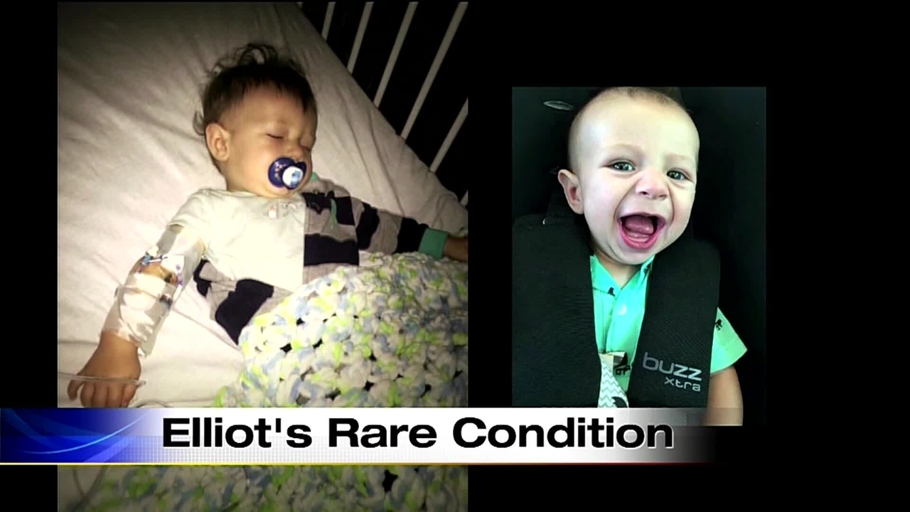 Extended cut Boy's rare condition means he can't eat